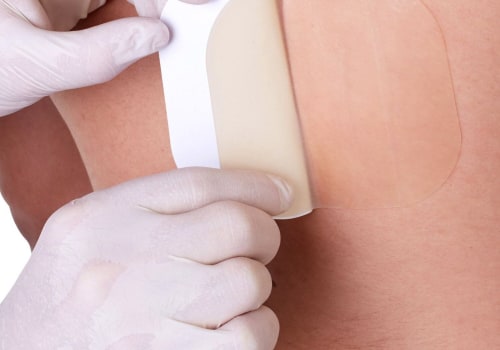 The Best Hydrocolloid Dressing Examples for First-Degree Burn Recovery